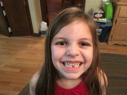 Greta first missing tooth